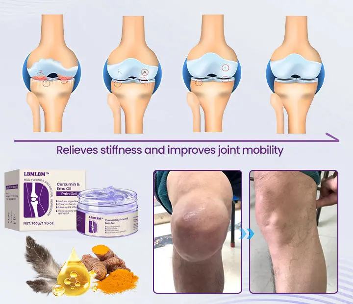 LBMLBM™ Curcumin & Emu Oil Pain Gel