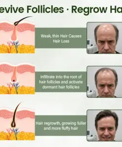 LBMLBM™ Follicure BioGrow Hair Restoration Spray