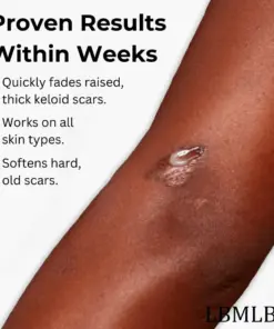 LBMLBM™ Medical-Grade Silicone Scar Gel
