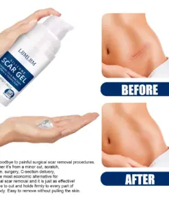 LBMLBM™ Medical-Grade Silicone Scar Gel