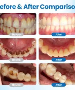 LBMLBM™ NanoHAP Tooth Defense Serum