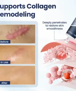 LBMLBM® Texture Repair Gel