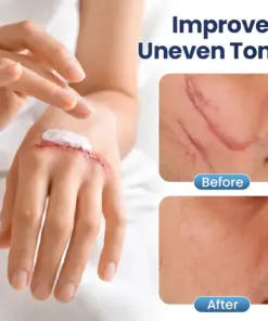 LBMLBM® Texture Repair Gel