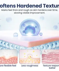 LBMLBM® Texture Repair Gel