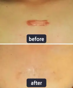 LBMLBM® 𝐀𝐝𝐯𝐚𝐧𝐜𝐞𝐝 𝐒𝐜𝐚𝐫 𝐑𝐞𝐩𝐚𝐢𝐫 & 𝐒𝐤𝐢𝐧 𝐑𝐞𝐧𝐞𝐰 𝐂𝐫𝐞𝐚𝐦