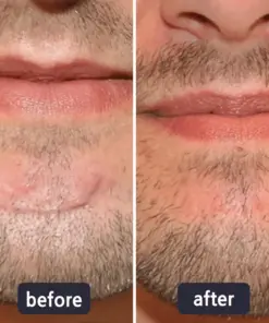 LBMLBM® 𝐀𝐝𝐯𝐚𝐧𝐜𝐞𝐝 𝐒𝐜𝐚𝐫 𝐑𝐞𝐩𝐚𝐢𝐫 & 𝐒𝐤𝐢𝐧 𝐑𝐞𝐧𝐞𝐰 𝐂𝐫𝐞𝐚𝐦