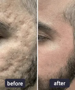 LBMLBM® 𝐀𝐝𝐯𝐚𝐧𝐜𝐞𝐝 𝐒𝐜𝐚𝐫 𝐑𝐞𝐩𝐚𝐢𝐫 & 𝐒𝐤𝐢𝐧 𝐑𝐞𝐧𝐞𝐰 𝐂𝐫𝐞𝐚𝐦