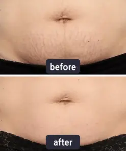 LBMLBM® 𝐀𝐝𝐯𝐚𝐧𝐜𝐞𝐝 𝐒𝐜𝐚𝐫 𝐑𝐞𝐩𝐚𝐢𝐫 & 𝐒𝐤𝐢𝐧 𝐑𝐞𝐧𝐞𝐰 𝐂𝐫𝐞𝐚𝐦