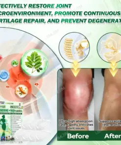 LBMLBM™ Moringa Berberine NAD 𝟏𝟎-𝐢𝐧-𝟏 𝐀𝐝𝐯𝐚𝐧𝐜𝐞𝐝 𝐍𝐚𝐧𝐨 𝐌𝐢𝐜𝐫𝐨𝐧𝐞𝐞𝐝𝐥𝐞 𝐏𝐚𝐭𝐜𝐡 𝐎𝐧𝐜𝐞 𝐃𝐚𝐢𝐥𝐲, 𝐕𝐢𝐬𝐢𝐛𝐥𝐞 𝐑𝐞𝐬𝐮𝐥𝐭𝐬 𝐢𝐧 𝟕 𝐃𝐚𝐲𝐬 For Weight, Skin, Diabetes Joint Health