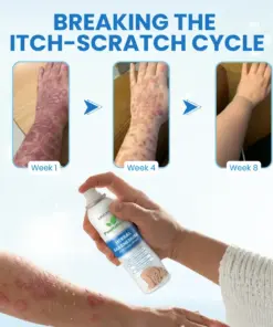 LBMLBM™ PsoriaHeal Herbal Magnesium Soothing Spray